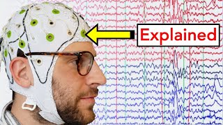 EEG Electroencephalogram Explained [upl. by Happy]