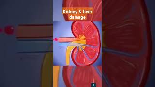 Alcohol can damage the liver kidney feedshorts foryou explore ytshorts kidney disease [upl. by Samaria]