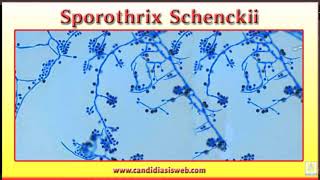 Snippet Lecture Sporothrix Schenckii [upl. by Liddie135]