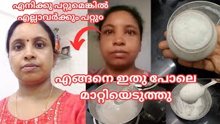 കറുത്ത മുഖവു൦ കരിമ൦ഗലൃവു൦ മാറ്റിയത് ഇങ്ങനെയാണ്how to make pigmentation face pack തെളിവ് സഹിത൦ [upl. by Janice]