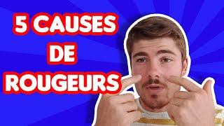 5 causes de rougeurs au visage [upl. by Cima]