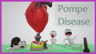 Pompe Disease Mnemonic for the USMLE [upl. by Adda]