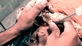 General Anesthesia Intubation Procedure  Young Girl Going Under Anesthesia  Anesthetic Waseem [upl. by Anomahs]