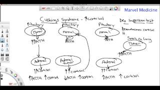 Cushings syndrome and the Dexamethasone suppression test [upl. by Nwahsud]