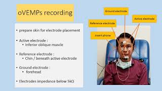 Vestibular Evoked Myogenic Potential [upl. by Staw]