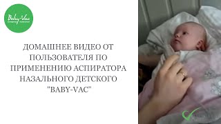 Применение BabyVac дома Аспиратор назальный детский BabyVac [upl. by Craggie]