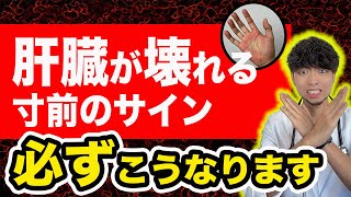 肝臓が壊れる寸前にだけ現れる危険サイン７選、必ずこうなります。 [upl. by Xad]