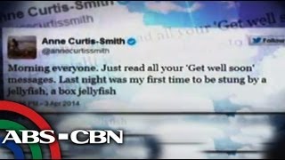 Anne Curtis tweets about jellyfish attack [upl. by Solakcin]