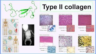 type II collagen [upl. by Heydon491]