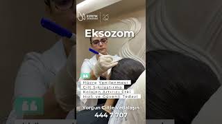 Exosome Treatment I Estetik International [upl. by Dorn857]