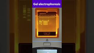 Gel electrophoresis Technique [upl. by Enilra]