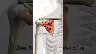 Subscapularis Trigger Points [upl. by Ahsiemak]