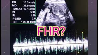 U Tell Me Baby Gender On Ultrasound 🙂  FHRV Cephalic or Breech  Placenta Posterior or Anterior [upl. by Ronacin918]