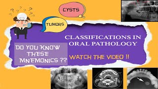 Oral pathology classifications made easy with mnemonics3rd year BDSBibliodent [upl. by Refinaj]