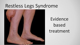 Restless Leg Syndrome evidence based treatment [upl. by Benil]