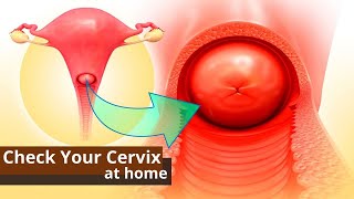 How You Can Check Your Cervix At Home  Best Ways to Know the Dilation of Cervix [upl. by Libna]