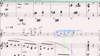 Sibelius 6 Quick Tip 4 Creating Ornaments [upl. by Nylkcaj]