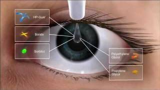 Alcon Dry Eye Video and Systane Ultra Action [upl. by Deelaw]