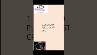 Choroid plexus cyst  Antenatal scan  Downs syndrome choroidplexuscyst [upl. by Johny]