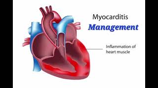 Myocarditis History Management mrcpch Clinical [upl. by Scarrow798]