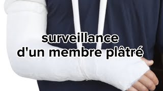 surveillance dun membre plâtré [upl. by Nimesay]