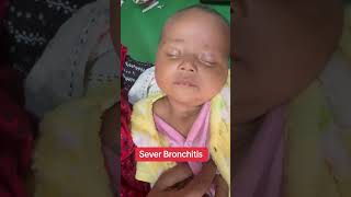 Severe Bronchitis drataurrahman newbornbaby baby crezyboy [upl. by Nimzzaj]