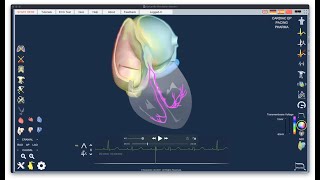 Introductory lecture on Epicardio Simulation™  ECG [upl. by Ahsened]