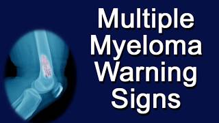 Multiple Myeloma Warning Signs [upl. by Rednave]