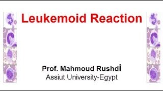 Leukemoid Reaction Arabic 2017 [upl. by Aicala]