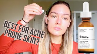 Best Vitamin C serum for Sensitive Acne Prone Skin The Ordinary Ascorbyl Glucoside 12 review [upl. by Lose]