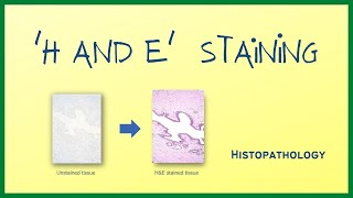 H amp E Staining  Hematoxylin and Eosin stain  Histopathology  Hindi [upl. by Ecniuq]