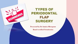 Periodontal Flap Surgery for Periodontitis [upl. by Dominick]