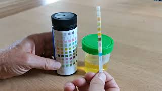 How to use urine test strips 10 parameters [upl. by Kassab896]