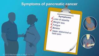 Pancreatic Cancer Signs Symptoms and Risk Factors [upl. by Aileen]