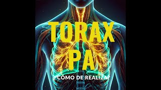 Cómo dominar la técnica de RX de tórax PA [upl. by Yllier625]