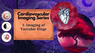 Imaging of Vascular Rings [upl. by Aleihs97]