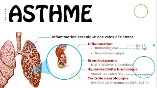 Asthme état stable  Cours  PneumoPhtisiologie [upl. by Mairem961]