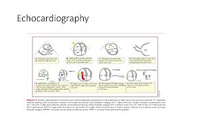 Pulmonary Embolism [upl. by Ynoep]