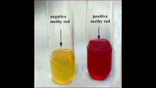 Methyl Red Test [upl. by Lorine834]