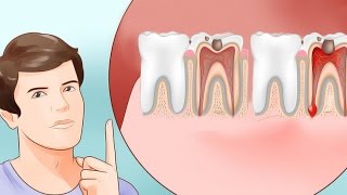 6 Proven Ways to Stop a Toothache and Relieve Pain [upl. by Grieve]