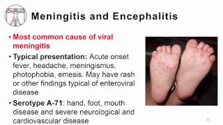 5 Enterovirus clinical manifestations including poliore [upl. by Pegasus57]