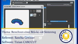 DentaltechnikCADCAMTeaser Brücke mit Sintersteg in der Tizian CAM berechnen [upl. by Huang]