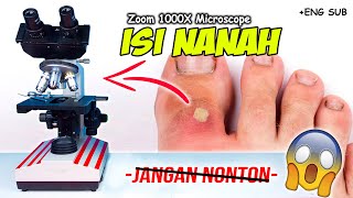 INILAH ISI NANAH DI MIKROSKOP  Pus Under Microscope Zoom 1000X [upl. by Hendren927]