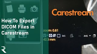 Carestream  How to export DICOM files [upl. by Olvan]