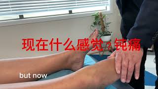 superficial peroneal nerve entrapment syndrome 腓浅神经皮支卡压症一例 [upl. by Eserehc480]