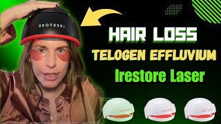 quotThe Ultimate Solution for Hair Regrowth iRestore Elite Laser System Reviewquot [upl. by Sirahs]