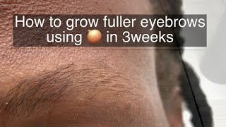 How To Grow Thicker Eyebrows Naturally and Faster [upl. by Carr]