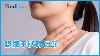 甲狀腺結節會演變成甲狀腺癌嗎？ － 吳少君耳鼻喉科專科醫生＠FindDoccom [upl. by Emmuela]