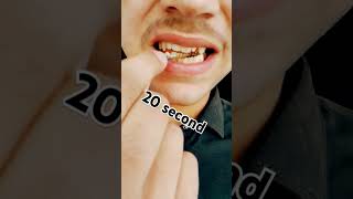 Ingrown teeth soft spot ingrowntoenailsurgery dentist teeth teethwhiting smile [upl. by Ysac]