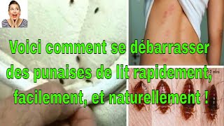 Voici comment se débarrasser des punaises de lit rapidement facilement et naturellement [upl. by Safko]